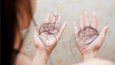 Saç Dökülmesi Nedenleri, Tedavileri ve Önleme Yolları