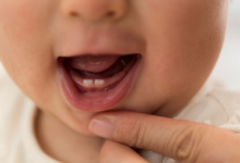 Bebeklerde Diş Çıkarma Süreci ve Belirtileri